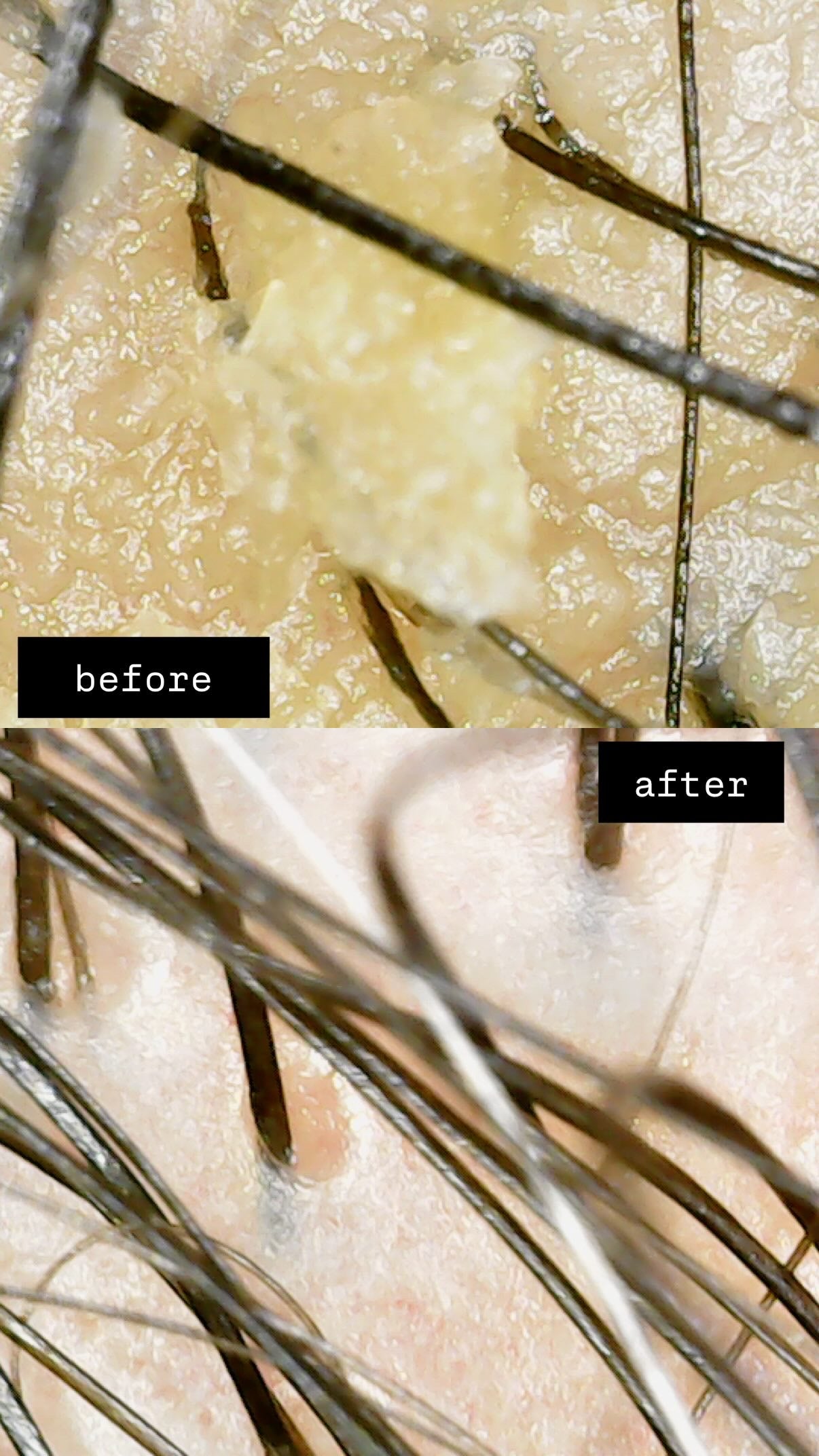 Scalp Reset Kit
