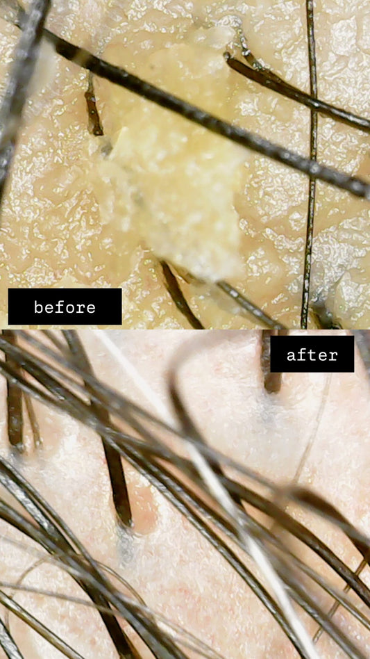 Scalp Reset Kit